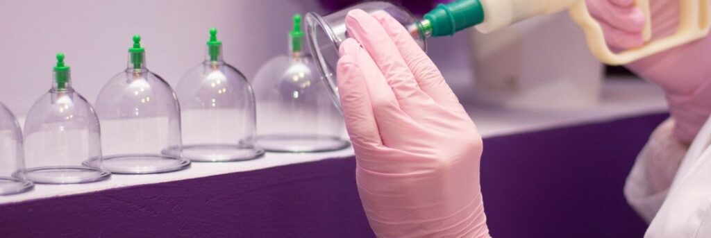 Hijama Dubai