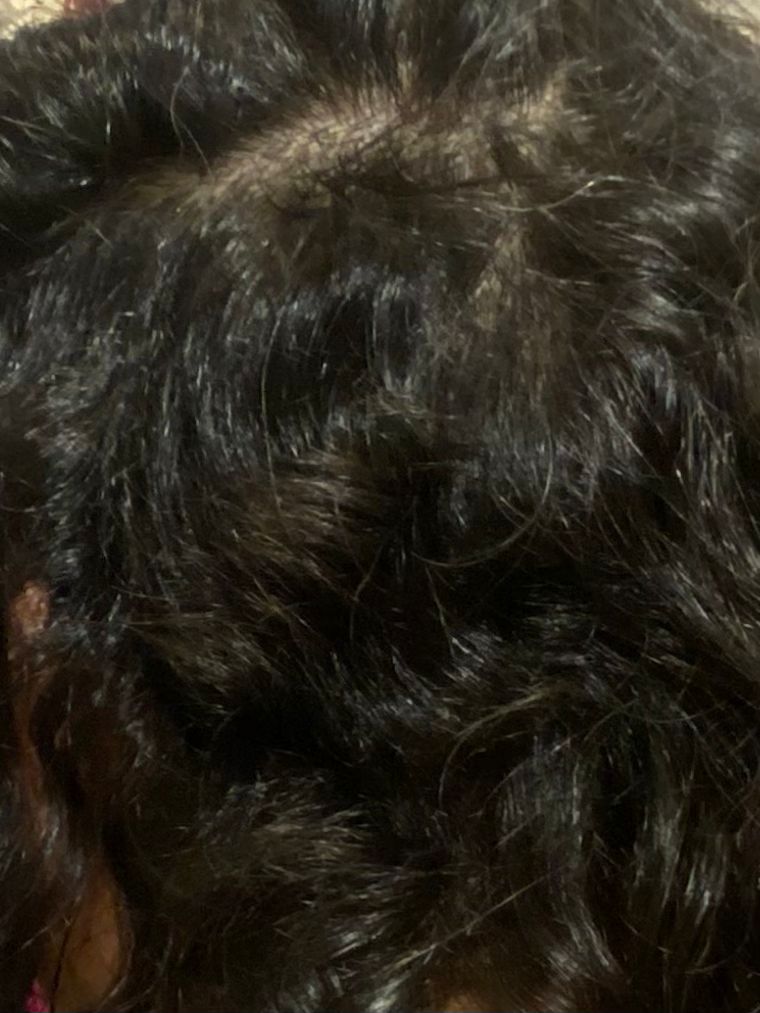 Hair treatment after result